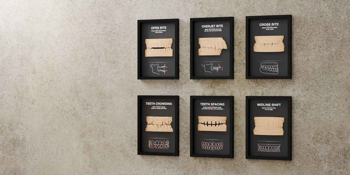 TRAPT professional layered frames displayed in a warm gallery interior